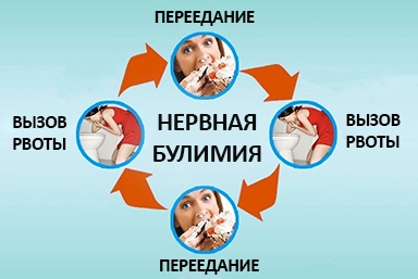 Лечение булимии в Аркадаке